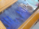hos_2060_36